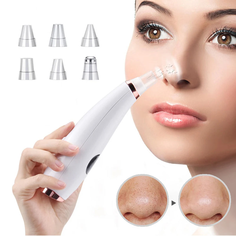 Electric blackhead remover