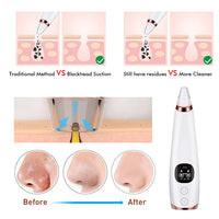 Electric blackhead remover