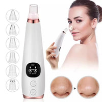 Electric blackhead remover