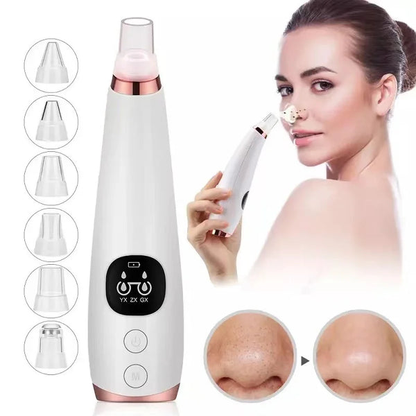 Electric blackhead remover