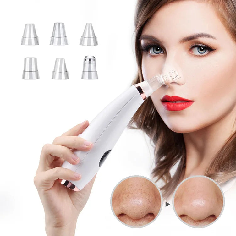 Electric blackhead remover