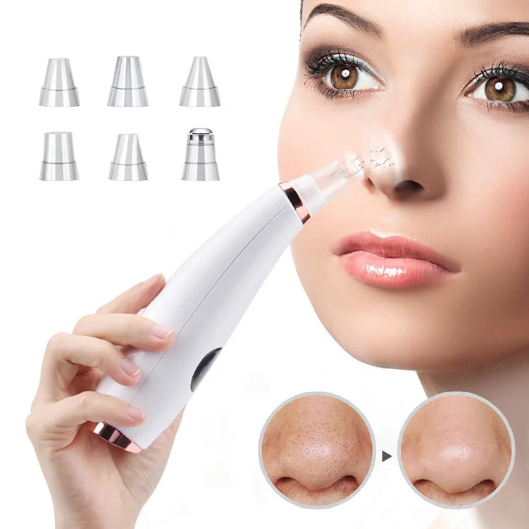 Electric blackhead remover